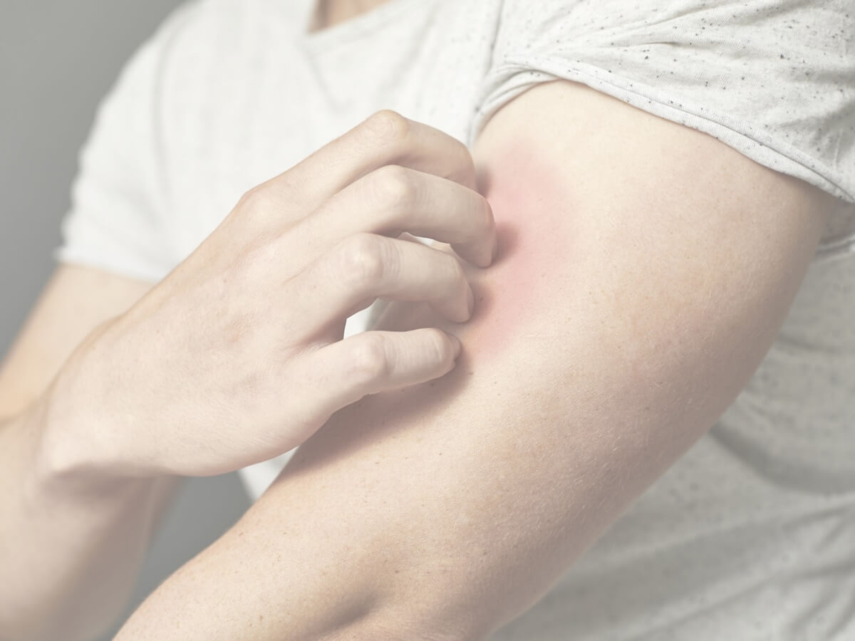 Symptome bei Neurodermitis