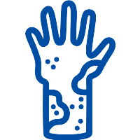 Icon Akutes Kontaktekzem
