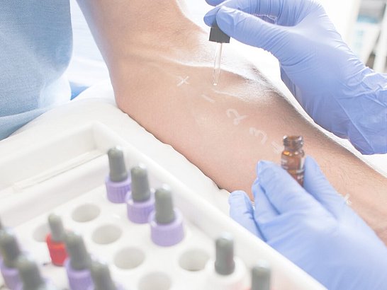 Diagnose durch Hauttestung