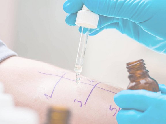 Finde deinen Allergologen in der Nähe, um ebenfalls einen Allergietest am Unterarm durchzuführen